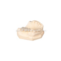 Custom Dental Layered Zirconia